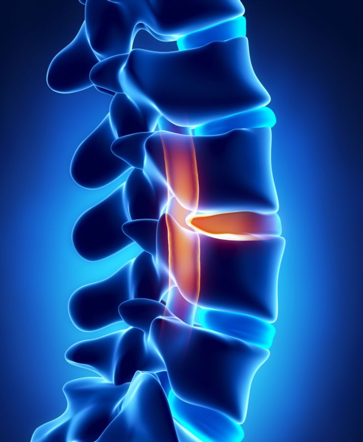 spinal-cord-injury-lawyer