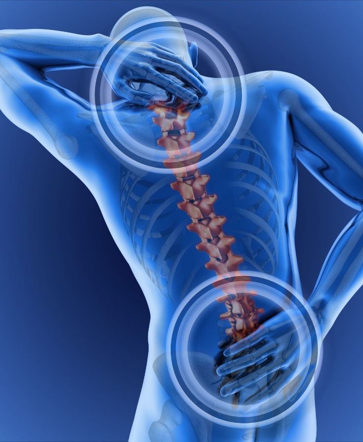 rear-end-accident-back-pain